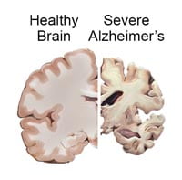brain_slices