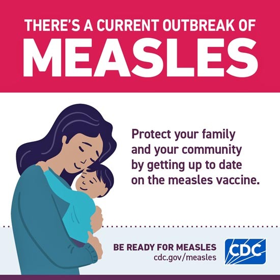 measles-outbreak-cdc